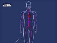 angioplasty catheter 1