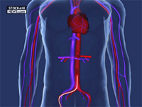 angioplasty catheter 2